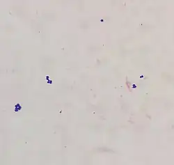 A few large, spherical, purple bacteria in small clusters on a faded pink background